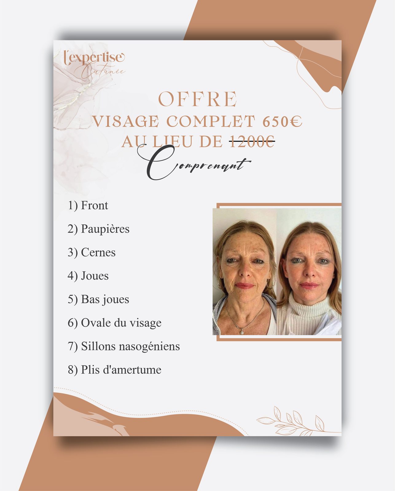 L'EXPERTISE — VISAGE OFFER design project